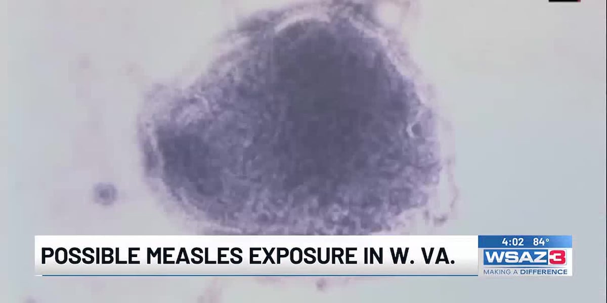 Measles Alert in West Virginia: Protect Yourself Before International Travel