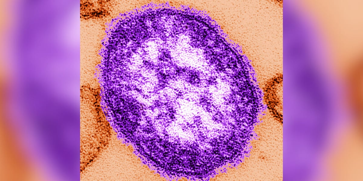 Health officials warn of possible measles exposure in W.Va. - WSAZ