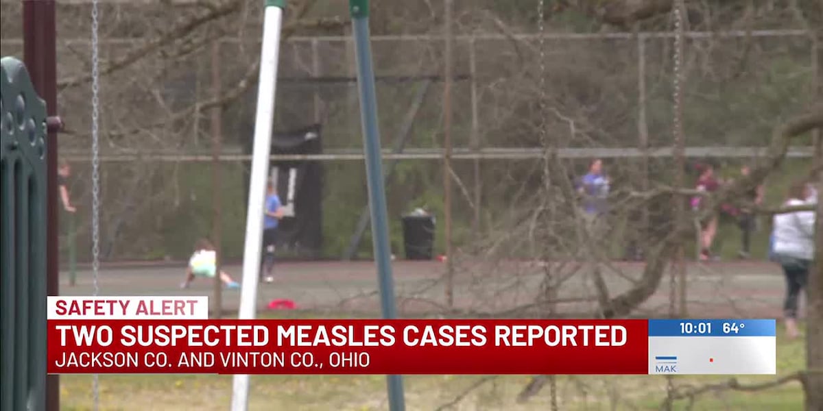 Two suspected measles cases reported
